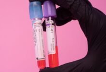 اختصارات تحليل الدم