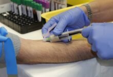 تحليل معدل الترسيب