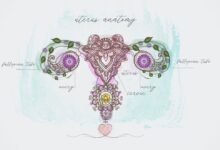 علاج قرحة المهبل بدون كي